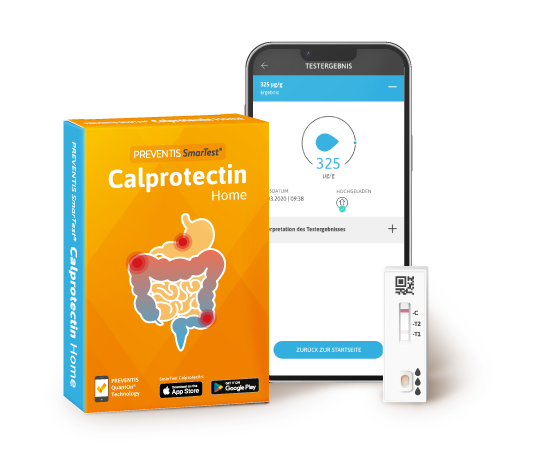 Verpackung des Selbsttests SmarTest Calprotectin Home für CED-Erkrankte; daneben ein Smartphone mit dem Calprotectin-Wert auf dem Bildschirm und eine Schnelltestkassette.